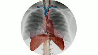 Radiographie thoracique  le signe de silhouette [upl. by Shifrah]