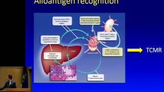 Liver Transplant Immunology [upl. by Manuel459]