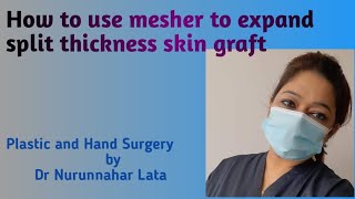 How to use mesher to expand split thickness skin graft [upl. by Ain298]