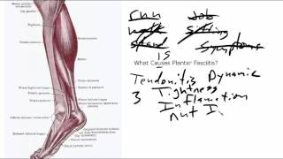 Plantar Fasciitis Is Not A Foot Problem [upl. by Mintz]