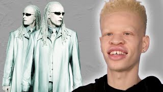 People With Albinism Review Albino Characters From Film [upl. by Gambell720]