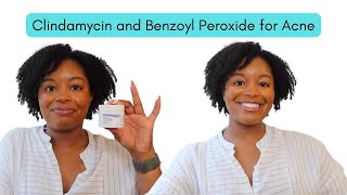 Doctor explains how to use BENZOYL PEROXIDE for ACNE aka PanOxyl  Acnecide  Side effects amp more [upl. by Ilocin]