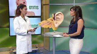 Causas y síntomas de la otitis HOY EN SALUD [upl. by Lawson]