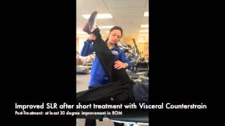 How Visceral Counterstrain can Increase a Straight Leg Raise [upl. by Fredkin]