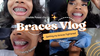 COME WITH ME TO GET MY BRACES TIGHTENED  BRACES VLOG 😁✨ [upl. by Atinrahs]