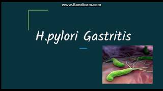 Helicobacter pylori gastritis Pathogenesis and morphology [upl. by Ydnas606]