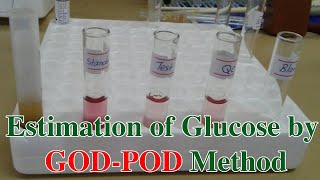 Glucose Estimation Method Estimation of Blood Glucose by GODPOD Method [upl. by Flem779]