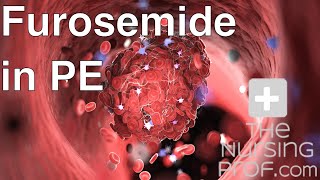 Furosemide in Pulmonary Embolism [upl. by Essilem712]