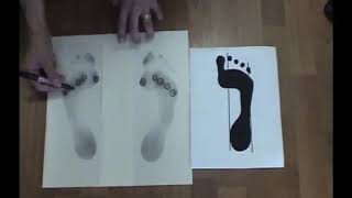 Natural Foot Orthotics Overview [upl. by Reggi]