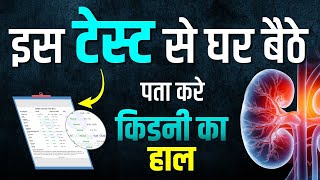 इस टेस्ट से घर बैठे पता करे किडनी का हाल  Kidney Function Test in hindi  Karma Ayurveda [upl. by Rolyt]