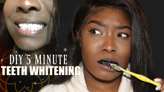 5 MINUTE TEETH WHITENING  DIY CHARCOAL TOOTHPASTE [upl. by Leffen402]