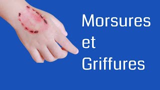 Morsures et Griffures  Dr Mohamed Zeroual [upl. by Erwin922]