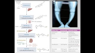 CÓMO SABER SI TE FALTA VITAMINA D  Síntomas Y Enfermedades Por Deficiencia De Vitamina D [upl. by Sueahccaz]