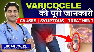 What is Varicocele  Its Causes Symptoms and Treatment हिन्दी [upl. by Lanrev680]