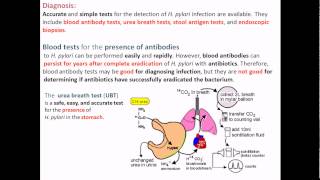 Helicobacter pylori diagnosis [upl. by Ris715]