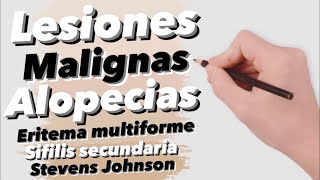 Aprende DERMATOLOGÍA Con CASOS CLÍNICOS 1 Lesiones malignas alopecias eritema multiforme… [upl. by Hooker832]