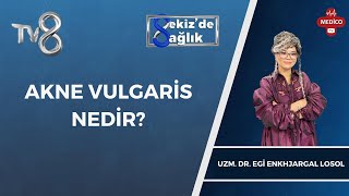 Akne Vulgaris Nedir  Uzm Dr Egi Enkhjargal Losol  8de Sağlık [upl. by Adine902]