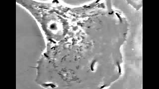 Listeria monocytogenes se déplaçant dans le cytoplasme de cellules infectées [upl. by Ansell194]