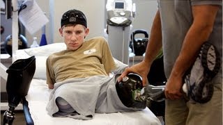 US soldier recovers after losing all four limbs [upl. by Eahsed210]