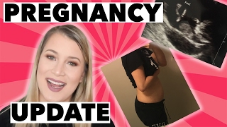 13 WEEK PREGNANCY UPDATE [upl. by Magdalena637]