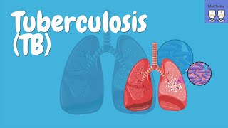 Pathophysiology of Tuberculosis Mycobacterium tuberculosis Epidemiology Primary TB Latent TB [upl. by Coop]