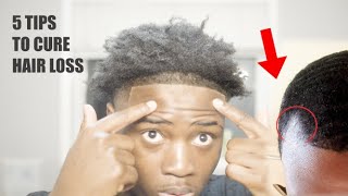 How To Naturally Cure Hairloss  a Receding hairline  and Thinning in 30 days [upl. by Iatnohs]