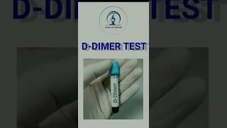 DDimer Test 💉🩸blood ddimer clot labtechnician easyparamedicallecture medical [upl. by Ariane178]