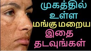 How to Cure Melasma  Pigmentation  Mangu maraiya  Get Clean amp Clear Skin  Tamil Beauty tips [upl. by Anceline]