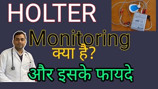 Holter monitoring की पूरी जानकारी हिंदी में [upl. by Lallage284]