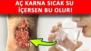 AÇ KARINA SICAK SU İÇERSEN NE OLUR [upl. by Eigriv]