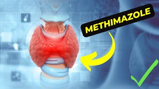 Methimazole A Breakthrough Medication for Hyperthyroidism Treatment [upl. by Luelle]