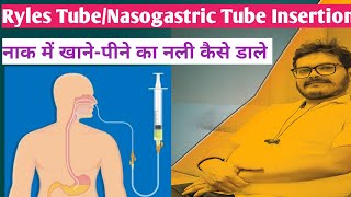 ryles tube insertion nasogastric tube insertion hindi technique NG Tube RT Insertion Dr Satish [upl. by Barnie]