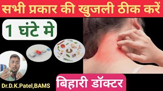 sharir mein dane aur khujliKhujli ki dawapure sharir me khujli ka ilajAllergy treatment at home [upl. by Redlac]