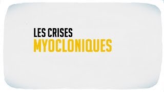 Les crises myocloniques [upl. by Rebmyk719]