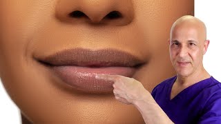 How to Plump Your Lips Naturally Dr Mandell [upl. by Tamberg945]