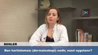 Ben haritalaması dermatoskopi nedir nasıl uygulanır [upl. by Giah937]