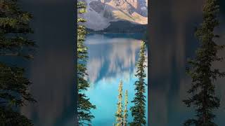 🏞️ Moraine Lake  Bucket List Destination [upl. by Ema]