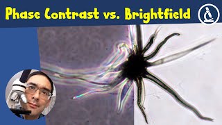 🔬 Brightfield vs Phase Contrast Microscopy Compared  Amateur Microscopy [upl. by Letreece]