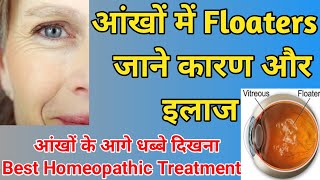 Eye floaters Eye floaters homeopathic medicine  आंखों के आगे काले धब्बो का इलाज By Dr Sanju Singh [upl. by Chassin809]