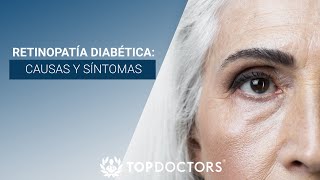 Retinopatía Diabética causas y síntomas [upl. by Loss20]