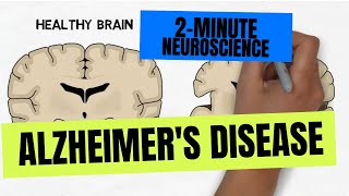 2Minute Neuroscience Alzheimers Disease [upl. by Hteboj]