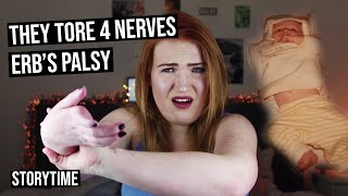 Erbs Palsy • THEY TORE 4 NERVES AT MY BIRTH  Storytime [upl. by Aloap512]