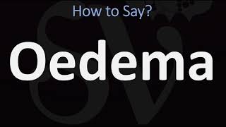 How to Pronounce Oedema CORRECTLY [upl. by Tterab221]