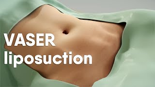 VASER liposuction is also called ultrasoundassisted liposuction VASER lipo or LipoSculpting [upl. by Chapman968]