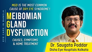 Meibomian Gland Dysfunction Causes Symptoms and remedy for dry eyes MGD by Dr Saugata Poddar [upl. by Esened574]