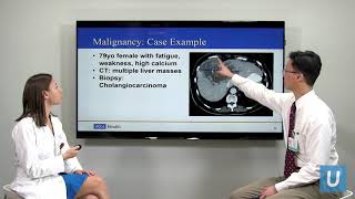 Causes of High Calcium  Masha Livhits MD amp Michael Yeh MD  UCLAMDChat [upl. by Labors]