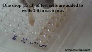 Treponema Pallidum Hemagglutination TPHA test for syphilis [upl. by Kubiak447]