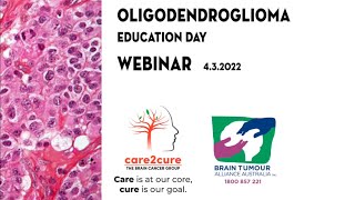 OLIGODENDROGLIOMA Education Day WEBINAR [upl. by Marnie921]