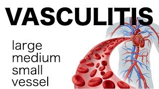 Vasculitis [upl. by Liggitt]