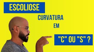 Curva da escoliose é em C ou em S Saiba como descobrir [upl. by Chu]